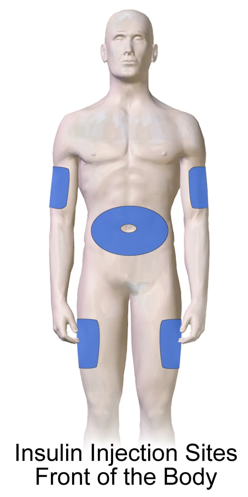 Recommended injection sites: abdomen, thigh, upper arm